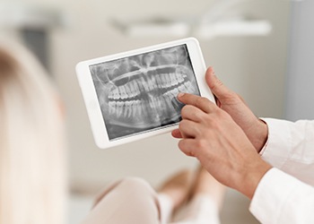 Digital dental x-rays on tablet computer