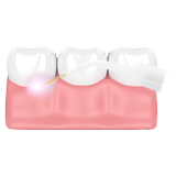 Animated gums during laser therapy icon