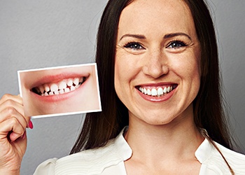 Smiling woman holding up comparison picture of smile before treatment