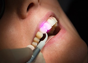 Patient receiving laser treatment